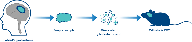 Glioblastoma Patient Derived Xenograft Models